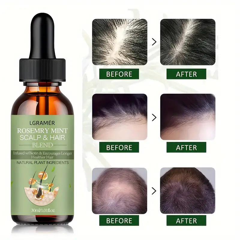 Lgramer 30ml Rosemary Mint Scalp And Hair Oil
